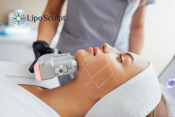 HIFU vs Botulinum Toxin: Understanding the Differences 1 HIFU vs Botox Great Missenden What is the best option for you?