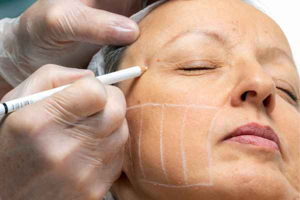 CryoPen: 5 Skin Concerns It May Be Used to Treat 4 What should you ask before having CryoPen treatment Great Missenden?