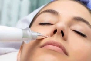 Best Actinic Keratoses Removal 3 Actinic keratoses Great Missenden solutions - book in today!