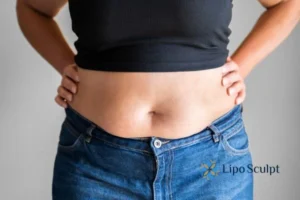 Bidding Farewell to Muffin Tops with Aqualyx Fat Injections 2 Do you wish you could reduce your muffin top Great Missenden With Aqualy fat dissolving injections you can!